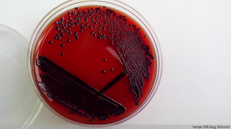 1-BAC24h菌落.jpg 1-BAC24h菌落.jpg