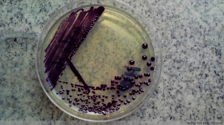 MHA 36h菌落.jpg MHA 36h菌落.jpg