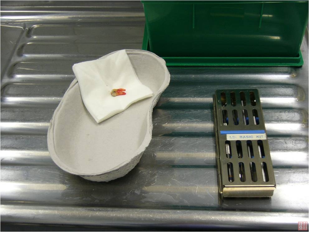 纸质换药碗与双面夹孔